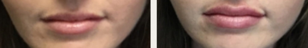 Lips3 (1)